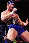 Degeneration-X